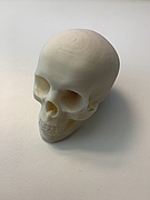 3D gedruckter Schädelknochen