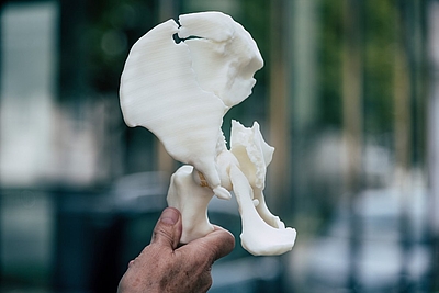 Maßgeschneidertes medizinisches Bauteil aus dem 3D-Drucker – gefertigt von HAGE3D